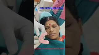 Alginate Impression Taking I impression making I Srikiran Dental [upl. by Akisej]