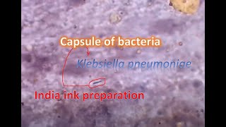 India ink preparation showing capsule of bacteria [upl. by Tserof]