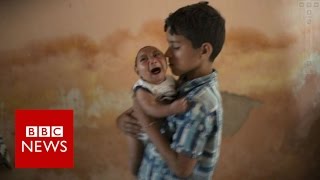 Brazil Zika outbreak What is happening to Brazils babies BBC News [upl. by Yenattirb]