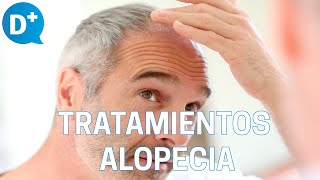 Los mejores tratamientos para combatir la alopecia [upl. by Eitsyrhc]