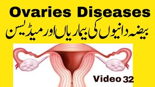 Ovaries Diseases treatment بیضہ دانیوں کی بیماریاں1 [upl. by Pollitt218]