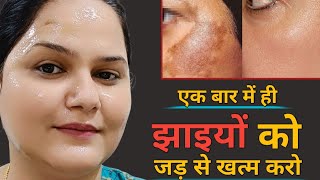 कितनी भी पुरानी झाइयांPigmentation जड़ से खत्म करो  How to Remove Pigmentation 100 Results [upl. by Munmro]