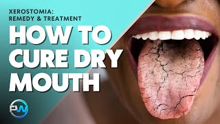 Xerostomia Dry Mouth Remedy amp Treatment To Cure The Symptoms And Causes Of Xerostomia [upl. by Llevad]