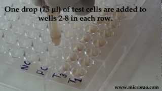 Treponema Pallidum Hemagglutination TPHA test for syphilis [upl. by Leirraj]