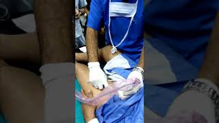 Ultrasound guided suprainguinal fascia iliaca block [upl. by Reinar]