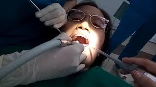 Dental Check Up and Painful Drilling on Woman [upl. by Akedijn]