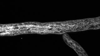 Análisis estructural de la catalasa de Neurospora crassa [upl. by Cyrilla665]