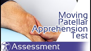 Moving Patellar Apprehension Test  Patellar Instability [upl. by Adiaj612]