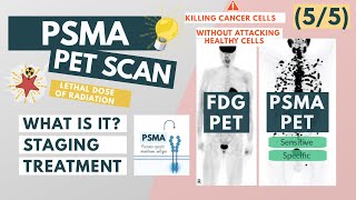 What is a PSMA PET scan  Overview for Med Students  Urology [upl. by Ahsekram410]