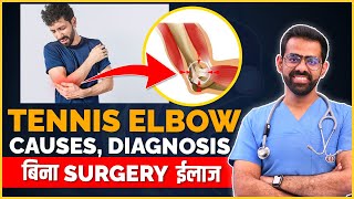 Tennis Elbow Lateral EpicondylitisCauses  Diagnosis  Non Surgical Treatment [upl. by Waters713]