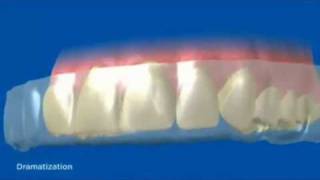 How Crest 3D Whitestrips Work [upl. by Devonna]