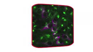 How to combine fluorescence and brightfield imaging [upl. by Maxa]