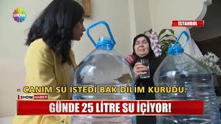 Günde 25 litre su içiyor [upl. by Aig836]