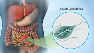 GIARDIA LAMBLIA  Etiología Clínica Diagnóstico y Tratamiento de Giardiasis  Parasitología 2023 [upl. by Alcott219]