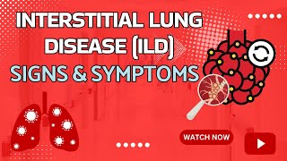 Interstitial Lung Disease Signs and Symptoms [upl. by Vey]