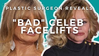 What went wrong with Goldie Hawn and Melanie Griffiths Facelifts [upl. by Anyat]