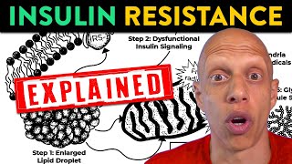 What Causes Insulin Resistance Unpacking the Effects of Excess Fat  Mastering Diabetes [upl. by Kcirderfla95]