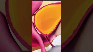 Urinary incontinence causes and symptoms 3danimation medicalanimation [upl. by Coney]