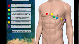 Electrocardiograma 01 Colocación Correcta de Electrodos [upl. by Price]