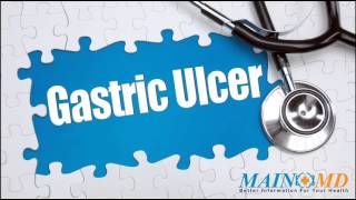 Gastric Ulcer ¦ Treatment and Symptoms [upl. by Eseenaj]