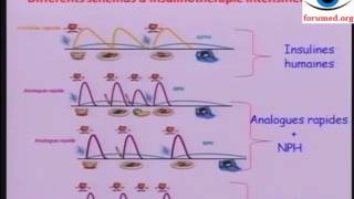 Traitement de diabète de type 1 insulinothérapie [upl. by Curt748]