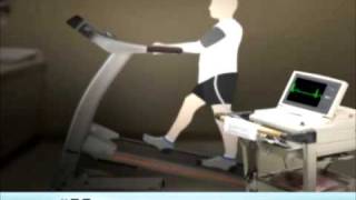 Exercise Stress Test [upl. by Reitman]