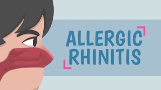 What is Allergic Rhinitis [upl. by Apollo]