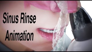 Sinus Rinse Animation [upl. by Hannavahs168]