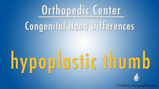 hypoplastic thumb  congenital hand differences  Boston Childrens Hospital [upl. by Muslim]