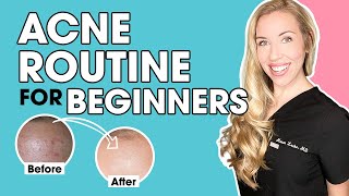 Acne Skincare Routine for Beginners  The Budget Dermatologist [upl. by Lexerd]