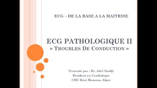 ECG Pathologique II  Troubles de Conduction Partie 01  BAV  BSA [upl. by Aratihc]