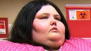 The Most Dramatic Transformations Ever Seen On My 600lb Life [upl. by Adihsaar260]