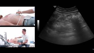 How to perform an ultrasound exam of the pancreas [upl. by Dalli]