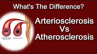 Arteriosclerosis Vs Atherosclerosis  Whats The Difference [upl. by Annah872]