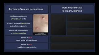 Transient neonatal pustulosis vs erythema toxicum neonatorum Dermatosis of infancy dermatology [upl. by Nreval]