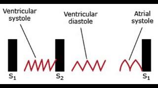 Constrictive Pericarditis [upl. by Jamille]