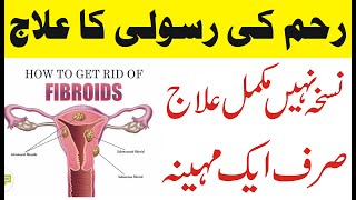 How To Treat Fibroids  Reham Mein Rasoli Ka Ilaj UrduHindi  Fibroids in UterusFibroids Ultrasound [upl. by Hoshi]