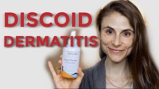 DISCOID NUMMULAR DERMATITIS TIPS FROM A DERMATOLOGIST DR DRAY [upl. by Kai698]