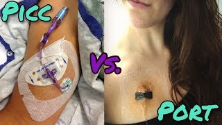 Picc line v Portacath  ProsCons Procedure Prep Tips amp Tricks [upl. by Lilybel224]