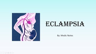 Eclampsia and its management [upl. by Annayi]