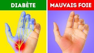 12 Problèmes de Santé Que Tes Mains T’indiquent [upl. by Consuela]