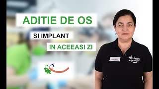 Poti face aditie de os si implant dentar in aceeasi zi Raspunde Dr Angelica Oprea [upl. by Efram687]