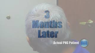 Psoriasis amp Alopecia Update [upl. by Bullis834]