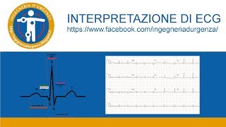 Interpretazione di ECG leggiamo insieme qualche elettrocardiogramma [upl. by Fay]