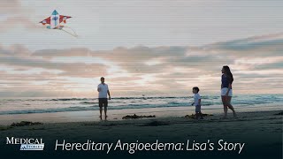 Medical Stories  Hereditary Angioedema HAE Lisas Story [upl. by Killian744]