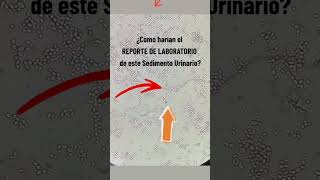 🤔¿Como Reportarían este Sedimento Urinario laboratorioclinico [upl. by Asseralc]