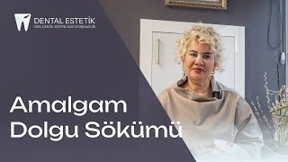 Amalgam dolgu sökümünde ortaya çıkan civa ve gümüş zararlı mı amalgam ankaradişhekimi [upl. by Labanna]