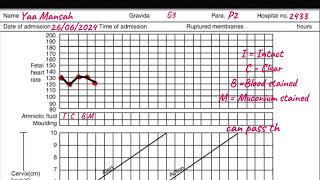 Partograph  How to plot the Partograph A step by step guide griphsacademy2024 [upl. by Nilreb]