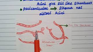 What are stromal Tumours of breast Fibroadenoma phyllodes tumor pathology robin [upl. by Vasileior]