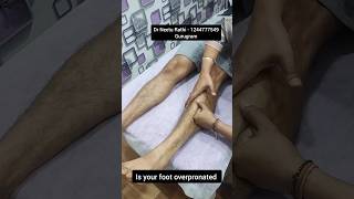 Pronated foot 🦶 feet 👣 trending ytshorts [upl. by Karena]